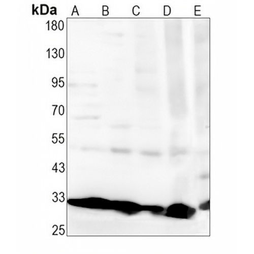 SNRPA Rabbit Monoclonal Antibody(C1366)