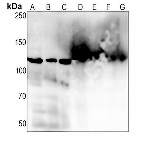 Matrin 3 Rabbit Monoclonal Antibody(C1367)