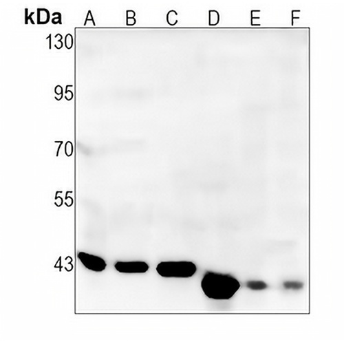 ILF2 Rabbit Monoclonal Antibody(C1368)