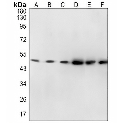 GLUD1 Rabbit Monoclonal Antibody(C1369)