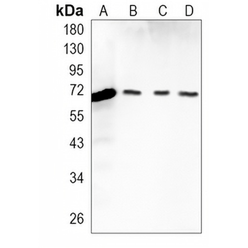 IGF2BP3 Rabbit Monoclonal Antibody(C1370)
