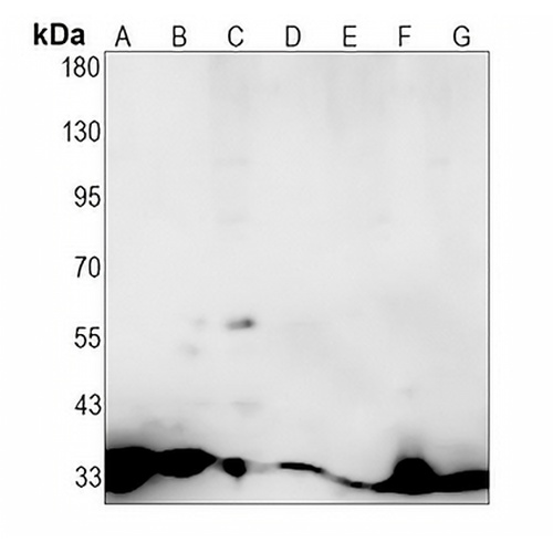 SPRY4 Rabbit Monoclonal Antibody(C1372)