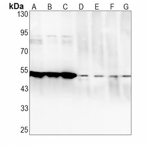RCK Rabbit Monoclonal Antibody(C1373)