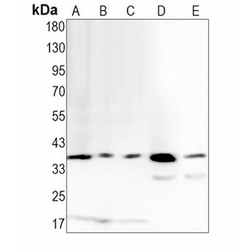 RING1b Rabbit Monoclonal Antibody(C1375)
