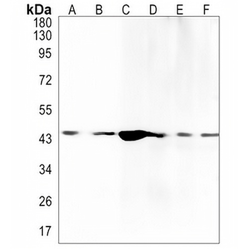 IDH1 Rabbit Monoclonal Antibody(C1376)