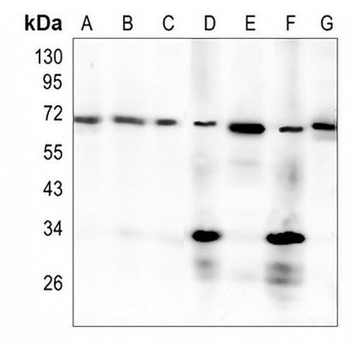 PDC-E2 Rabbit Monoclonal Antibody(C1378)