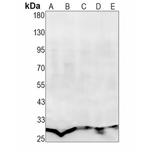 ERP29 Rabbit Monoclonal Antibody(C1379)