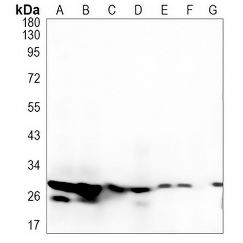 HIST1H1C Rabbit Monoclonal Antibody(C1381)