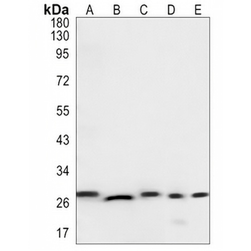 CHMP3 Rabbit Monoclonal Antibody(C1382)