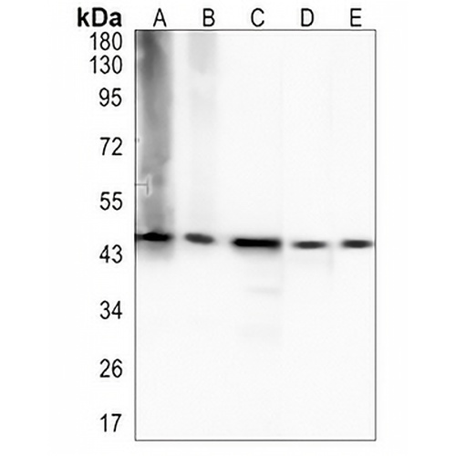 DDX39B Rabbit Monoclonal Antibody(C1384)