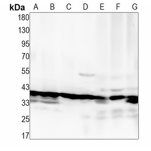 VPS26A Rabbit Monoclonal Antibody(C1385)