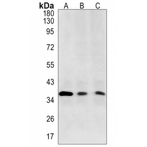 TARBP2 Rabbit Monoclonal Antibody(C1386)