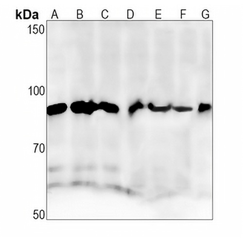 APPL1 Rabbit Monoclonal Antibody(C1387)
