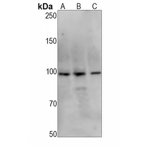 HIWI1 Rabbit Monoclonal Antibody(C1388)