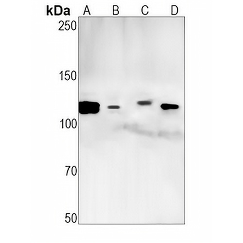 UBA1 Rabbit Monoclonal Antibody(C1390)