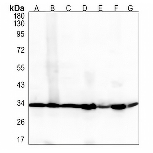 PHB2 Rabbit Monoclonal Antibody(C1394)