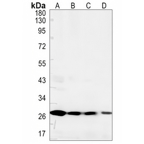 ANP32B Rabbit Monoclonal Antibody(C1396)