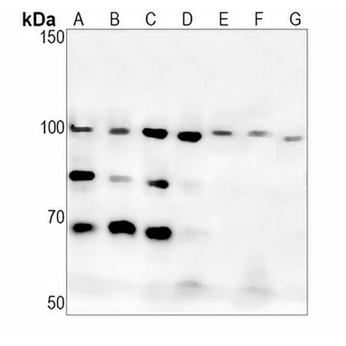 DISC-1 Rabbit Monoclonal Antibody(C1397)