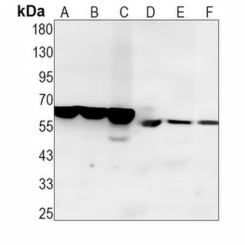 ABCE1 Rabbit Monoclonal Antibody(C1399)