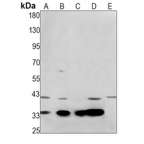 ACP5 Rabbit Monoclonal Antibody(C1401)