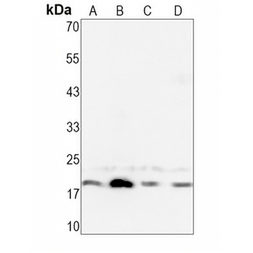 HES5 Rabbit Monoclonal Antibody(C1402)