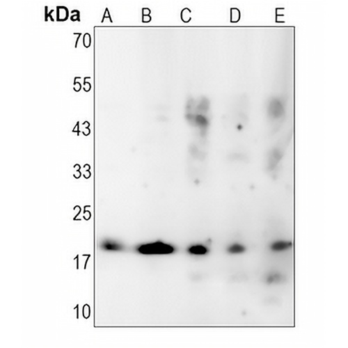 p18 INK4c Rabbit Monoclonal Antibody(C1403)