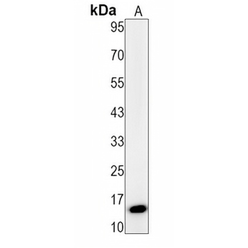 p14 ARF Rabbit Monoclonal Antibody(C1406)