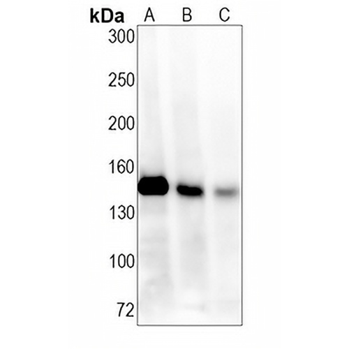 KDM4A Rabbit Monoclonal Antibody(C1407)