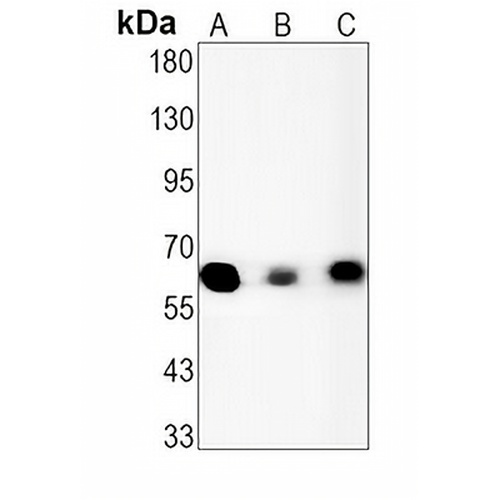 USP22 Rabbit Monoclonal Antibody(C1408)