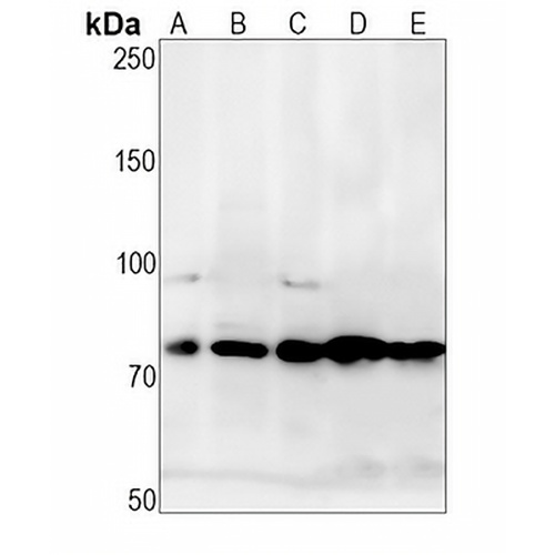 CD127  Rabbit Monoclonal Antibody(C1409)