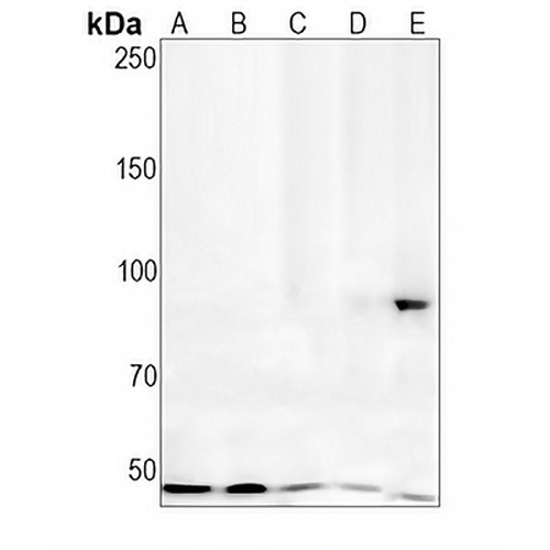 Villin Rabbit Monoclonal Antibody(C1414)