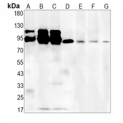 ILF3 Rabbit Monoclonal Antibody(C1415)