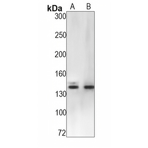 Pumilio 1 Rabbit Monoclonal Antibody(C1416)
