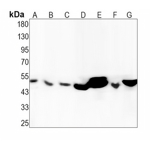 TMPRSS2 Rabbit Monoclonal Antibody(C1417)