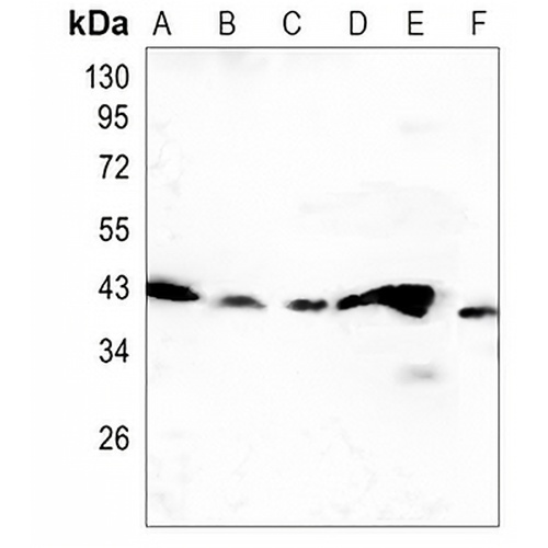 Creatine Kinase B Rabbit Monoclonal Antibody(C1418)