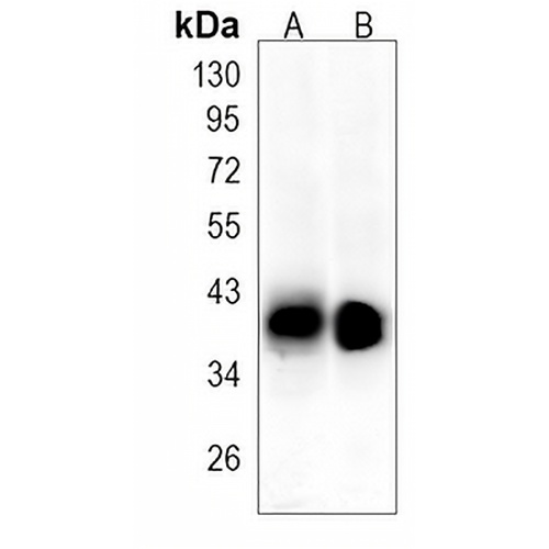 ADH1 Rabbit Monoclonal Antibody(C1419)