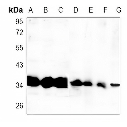 CHIP Rabbit Monoclonal Antibody(C1420)
