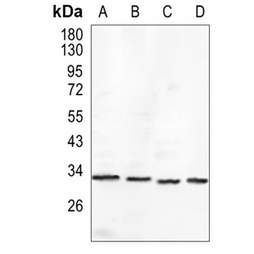 Tropomyosin Rabbit Monoclonal Antibody(C1423)