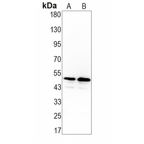 CD213a1 Rabbit Monoclonal Antibody(C1426)