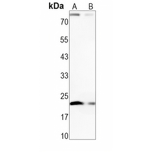 IL-23 alpha Rabbit Monoclonal Antibody(C1428)