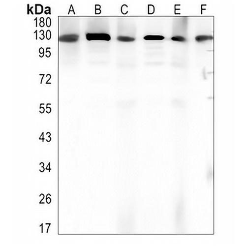 DDB1 Rabbit Monoclonal Antibody(C1429)