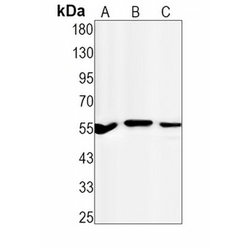 TAB1 Rabbit Monoclonal Antibody(C1431)