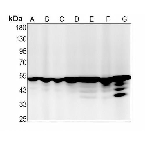 Glutathione Synthetase Rabbit Monoclonal Antibody(C1432)