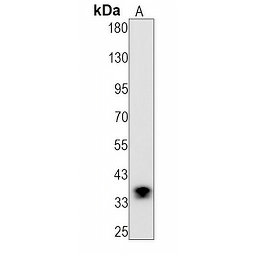 GDF15 Rabbit Monoclonal Antibody(C1433)
