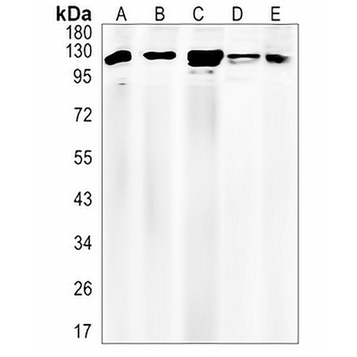 AP2-alpha-1 Rabbit Monoclonal Antibody(C1438)