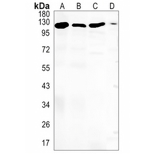SNF2H Rabbit Monoclonal Antibody(C1439)
