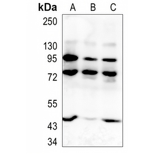 CD66b Rabbit Monoclonal Antibody(C1440)