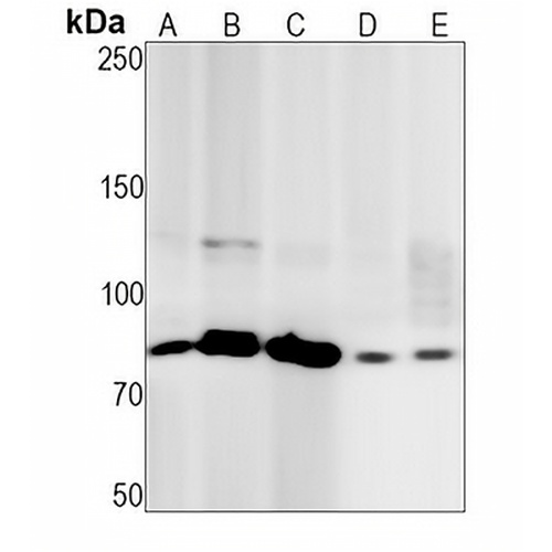Coilin Rabbit Monoclonal Antibody(C1441)