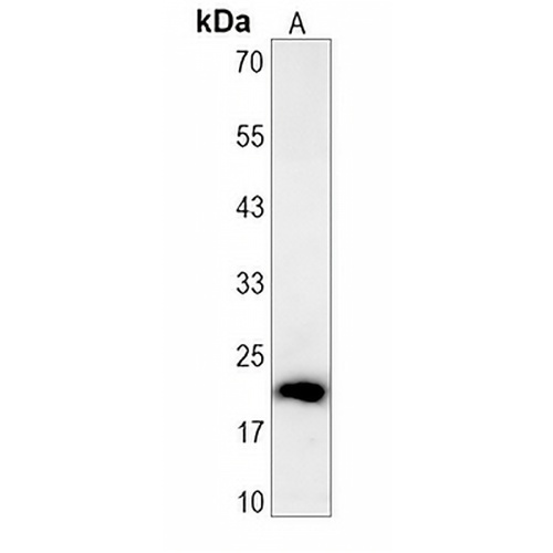 Perp Rabbit Monoclonal Antibody(C1442)