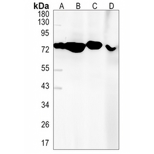 LysRS Rabbit Monoclonal Antibody(C1443)